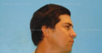 Ethan Barela