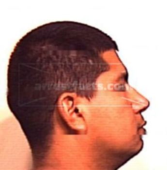 German Eduardo Perez