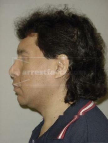 Eloy Salgado