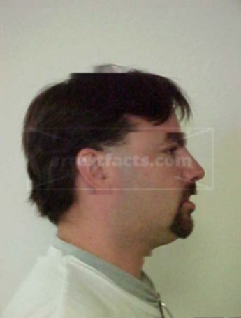 David E Rakotz
