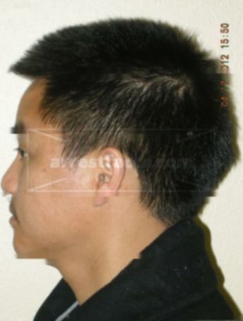 Vong Thao