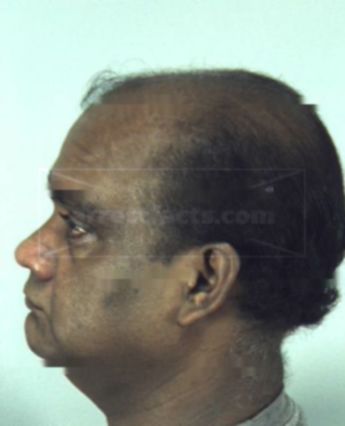 Kaso N Ramkaran