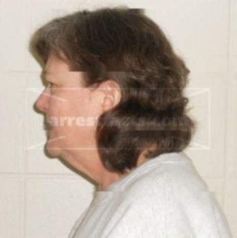 Brenda L Gammeter