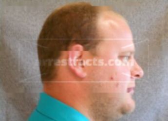 Brent J Fetzer