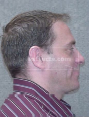 Gerald L Thunstrom