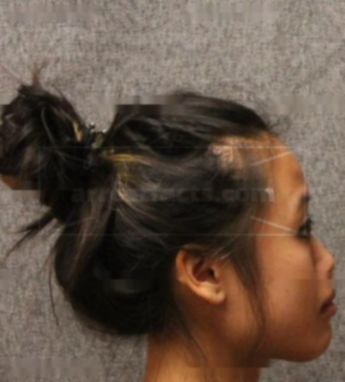 Lilian Fong