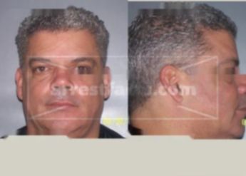 Camacho Rafael