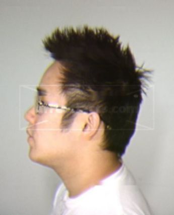 Xenophon Vu