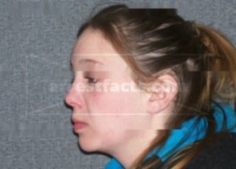 Samantha J Meuer