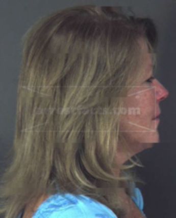 Ellen Flanigan Gilmore