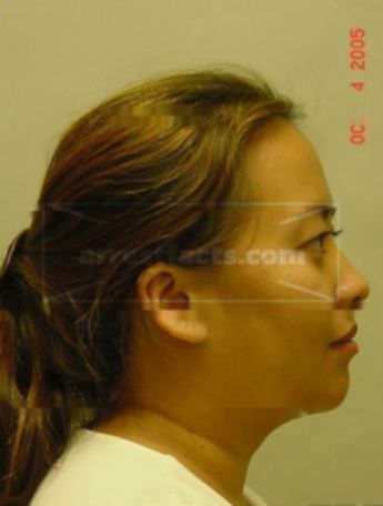 Mee Chang