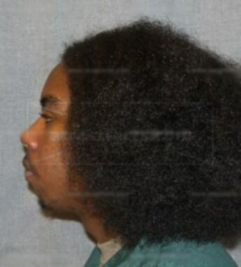 Deleon J Mosby