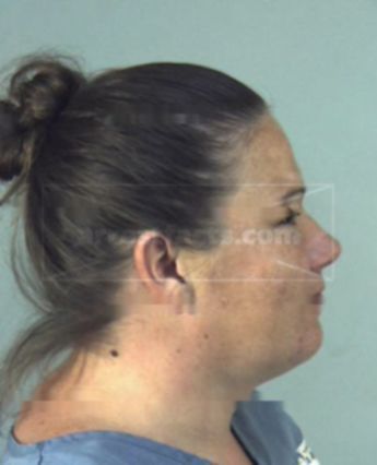 Melinda Suzanne Dotts
