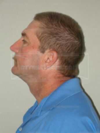 Thomas M Moss