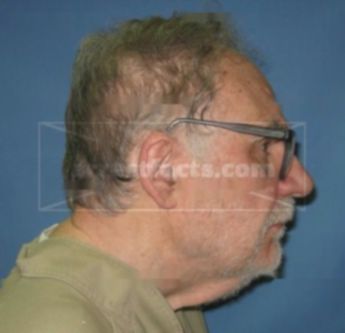 Richard H. Hellerman