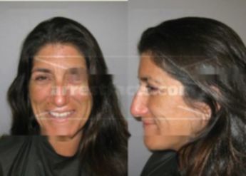 Michele Bella Cassesse