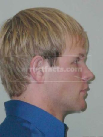 Ryan G Kleinschmidt