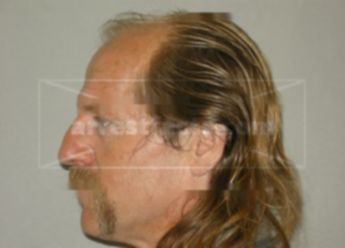 Robert L Flick