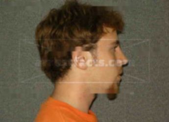 Andrew R Hoeft