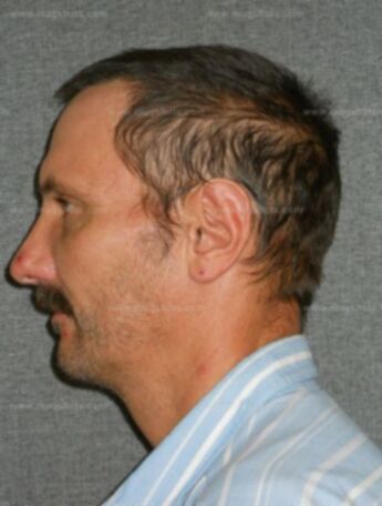 Harold W Gentner