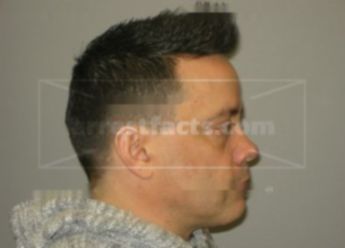 Marc J Bernarde