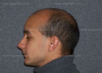 Luis A Colon