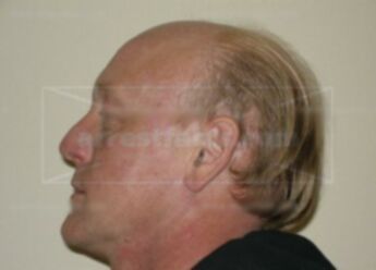 Richard L Henke Jr.