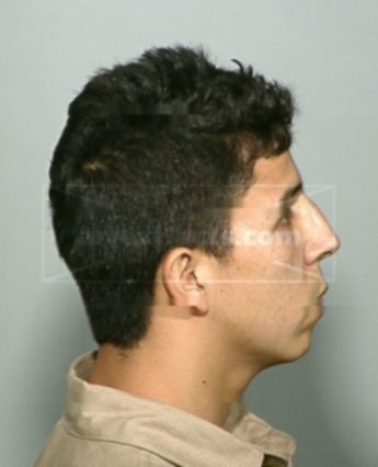 Franky Calderon