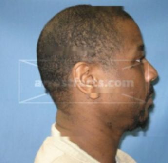 Michael Anthony Brumfield