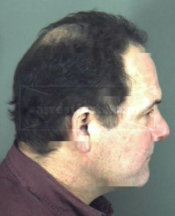 Arthur Benton Phelps
