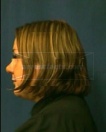 Allison L Ingram