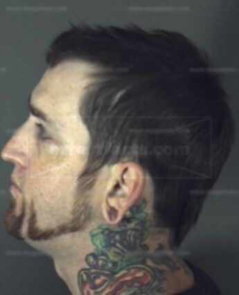 Ryan Mathew Boreske