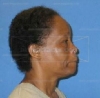 Arlene Mathis