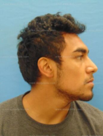 Victor Martinez