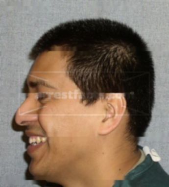 Alejandro Hernandez-Martinez