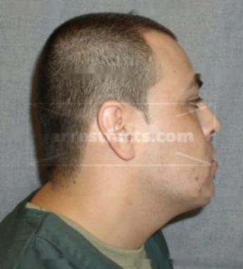 Alexis Rivera-Rivera