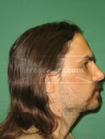 Kurt Prochaska