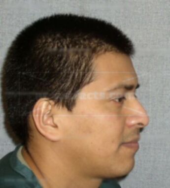 Alejandro Hernandez-Martinez