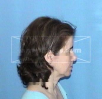 Ruth A. Landers