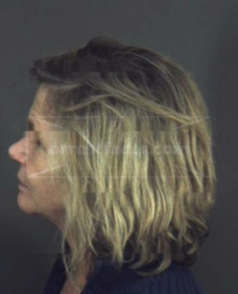 Bonnie Jean Washburn