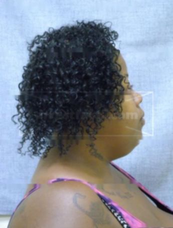 Tracee R Lewis