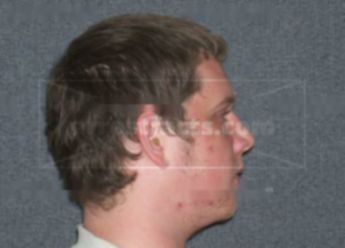 Devin J Lease