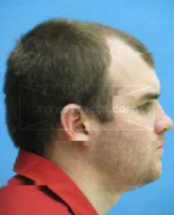 Travis Ashton Wynn