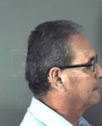 Fernando Arturo Calderon