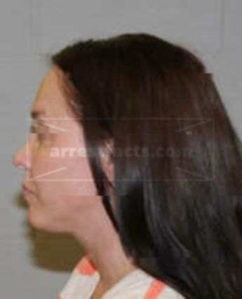Rachael Leanne Landis