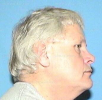 Kenneth D Reed