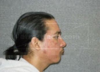Timothy J Stoehr