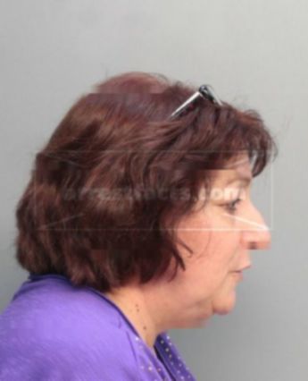 Mayra H Garcia-Perez