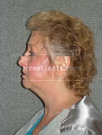 Brenda J Klein