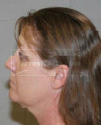 Stephanie Jeanne Dunn